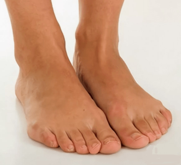 Zdravé nohy po ošetrení sprejom Hondrox