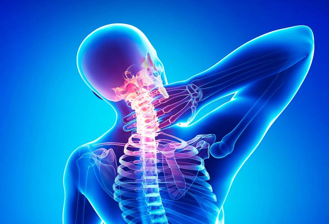 Osteochondróza chrbtice je bežnou chorobou, ktorá si vyžaduje liečbu. 