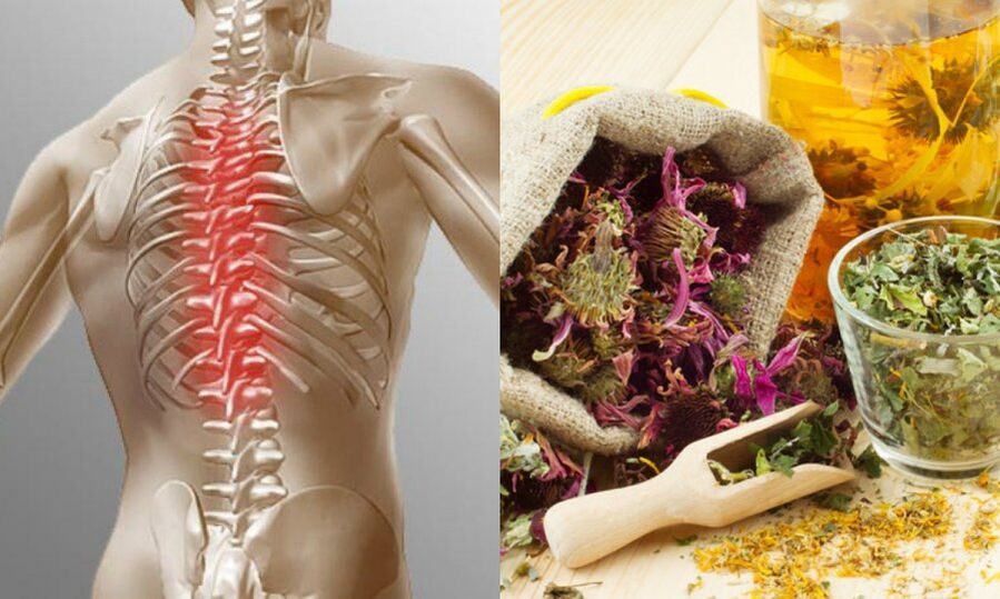Tradičné recepty - prevencia rozvoja osteochondrózy a podpora zdravia chrbtice