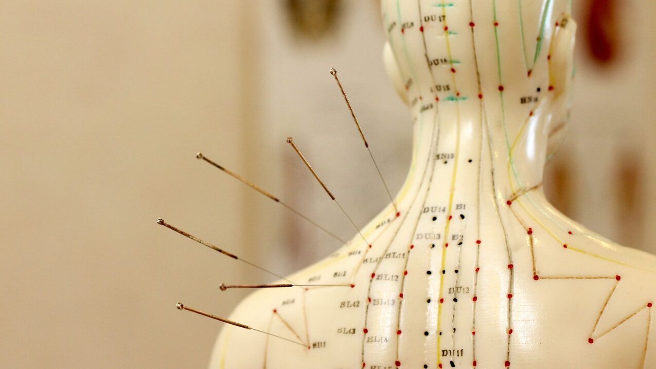 akupunktúra pre cervikálnu osteochondrózu